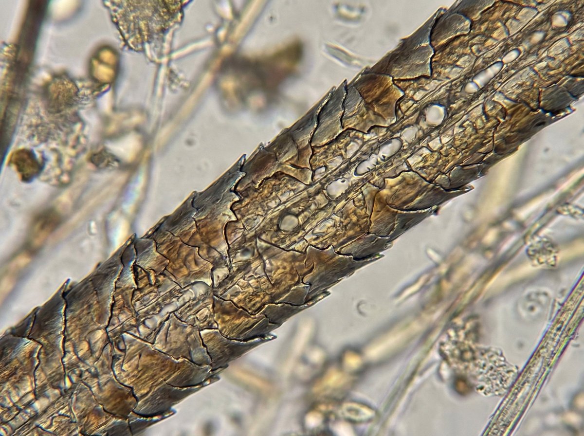 Microscopic View of a Subject — output 1