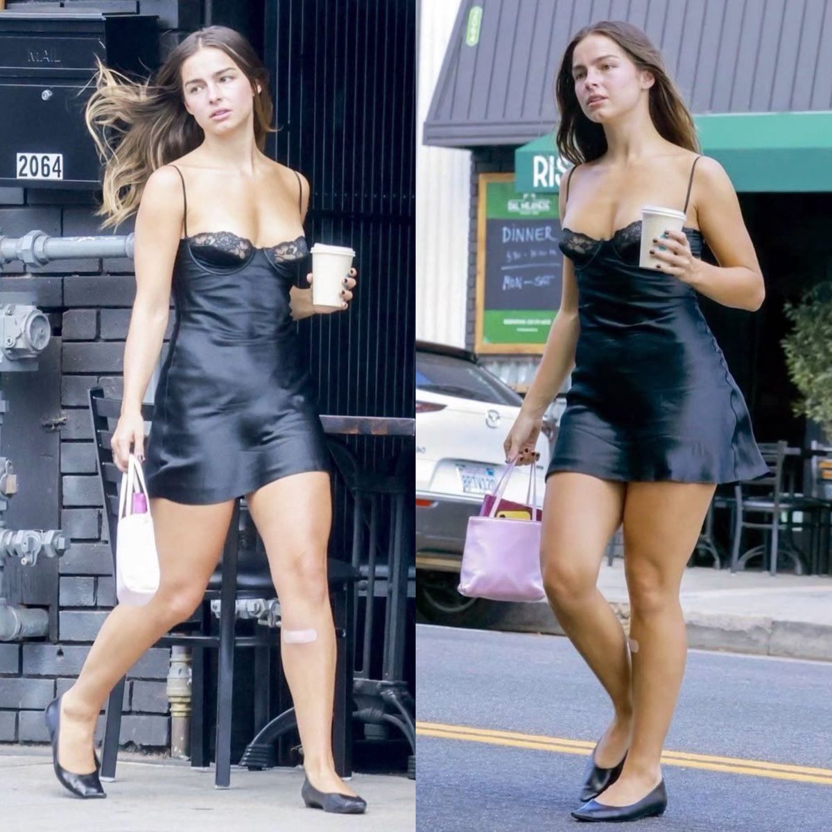 Candid Street Fashion Shot with Bandage Detail — output 1
